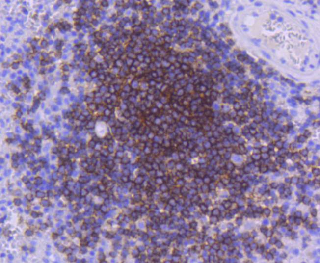 CD21 Rabbit mAb[48977]
