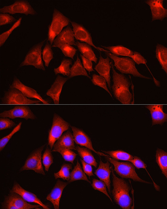 TRIM4 Polyclonal Antibody[2949