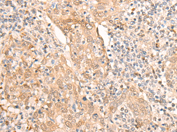 CELF2 Antibody[46949]