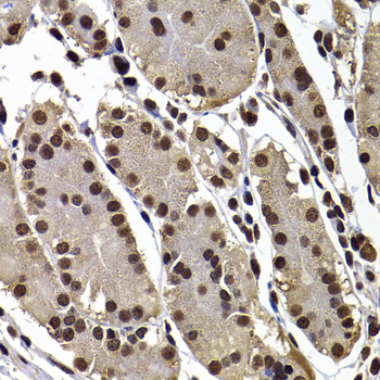GPS1 Polyclonal Antibody[30757