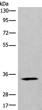 CCDC137 Antibody[46419]