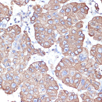 Cytokeratin-18 Polyclonal Anti