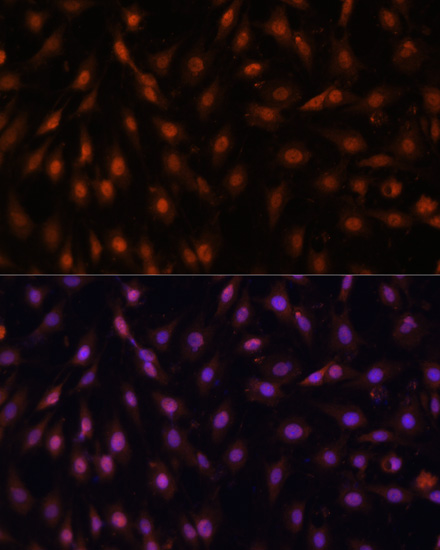 P70 S6K Polyclonal Antibody[29
