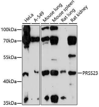 PRSS23 Polyclonal Antibody[299