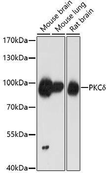 PRKCD Polyclonal Antibody[2904