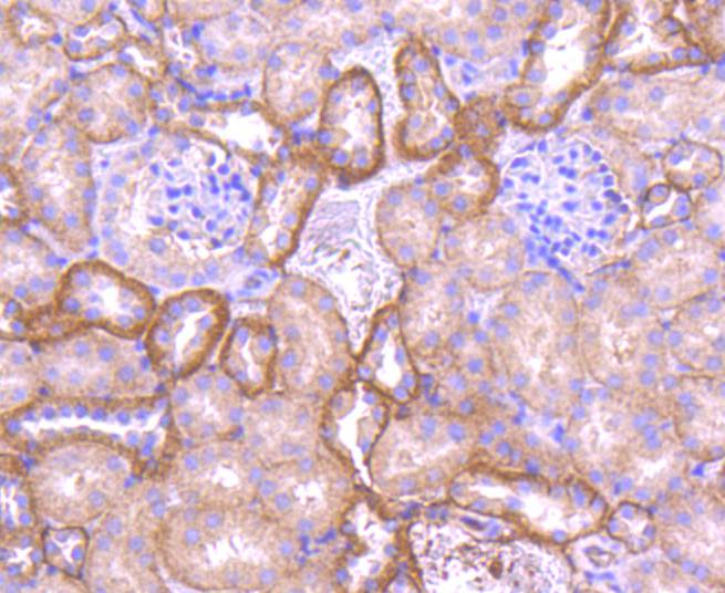 Pan-Cadherin Rabbit mAb[48907]