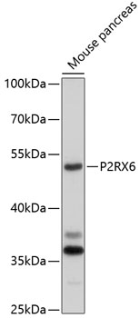 P2RX6 Polyclonal Antibody[2730