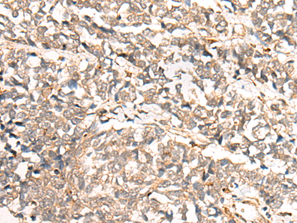 COMMD1 Antibody[46969]