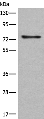 CAPN14 Antibody[46398]