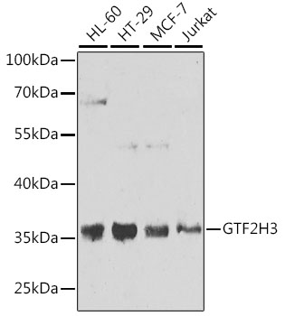 GTF2H3 Polyclonal Antibody[308