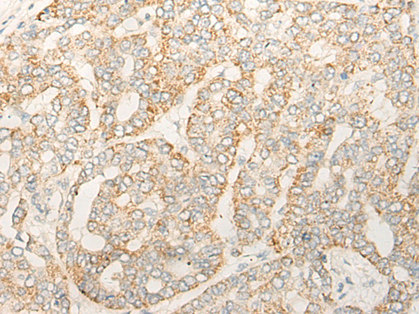 DZIP1 Antibody[47088]