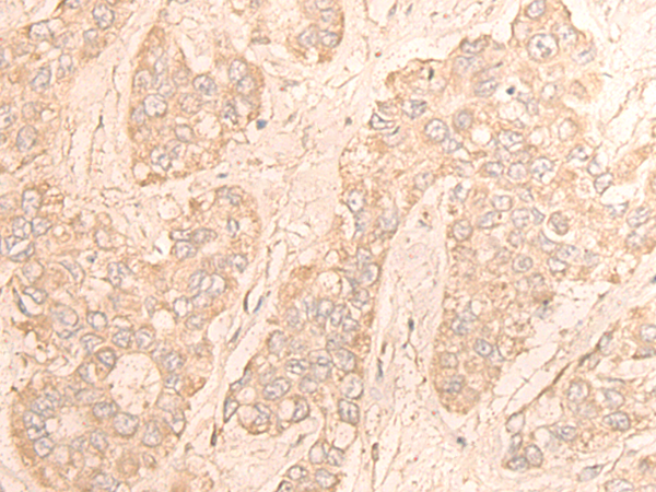 CDK18 Antibody[46946]