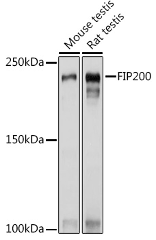 RB1CC1 Polyclonal Antibody[286
