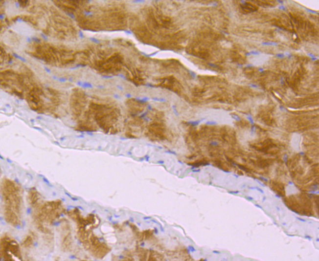 Zyxin Rabbit mAb[49705]