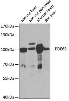 PDE6B Polyclonal Antibody[3076