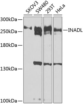 INADL Polyclonal Antibody[3156