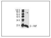 RBP Antibody[48333]