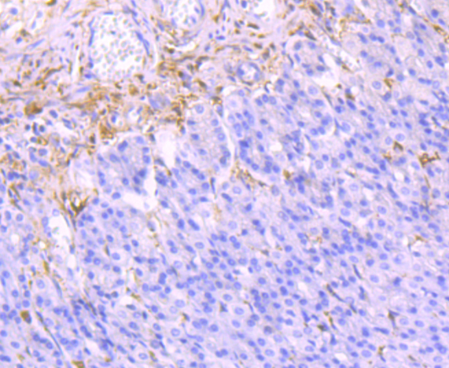 Galectin 1 Rabbit mAb[49673]