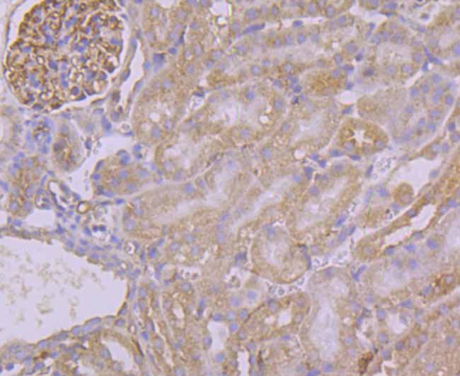 Pumilio 1 Rabbit mAb[49885]
