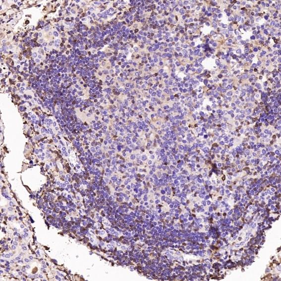 S100A4 Rabbit mAb[49121]