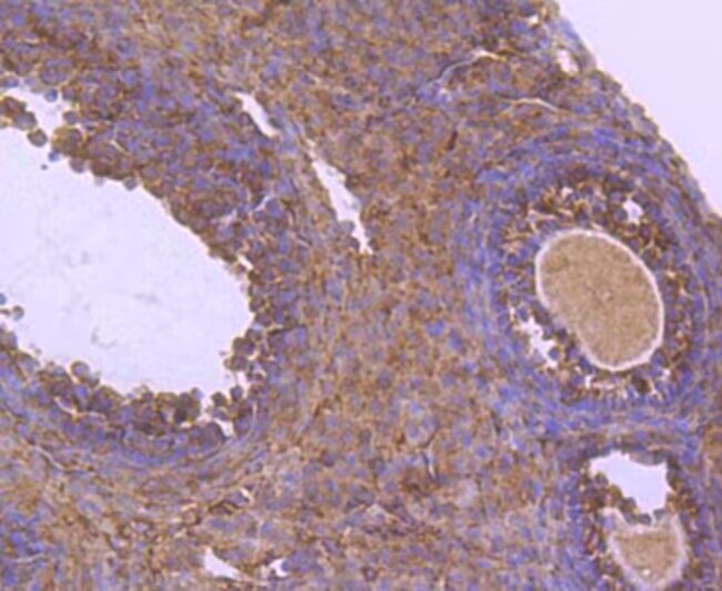 NUR77 Rabbit mAb[49510]