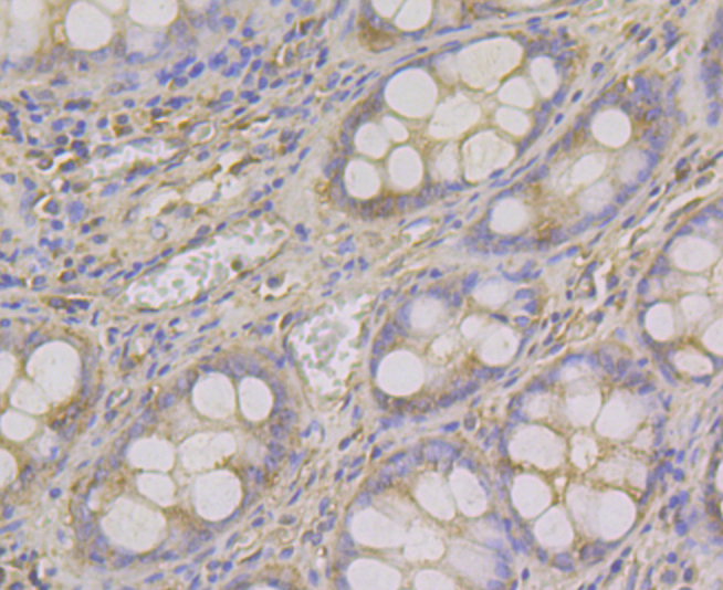 ADAMTS13 Rabbit mAb[49953]
