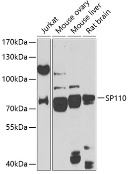 SP110 Polyclonal Antibody[2841