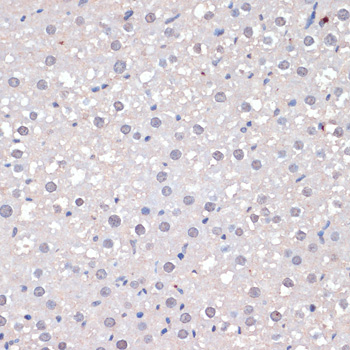 c-Jun Polyclonal Antibody[2908