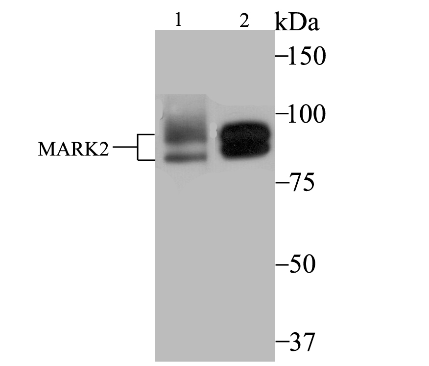 MARK2 Rabbit mAb[49983]