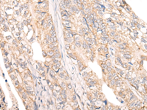 COPS8 Antibody[46535]