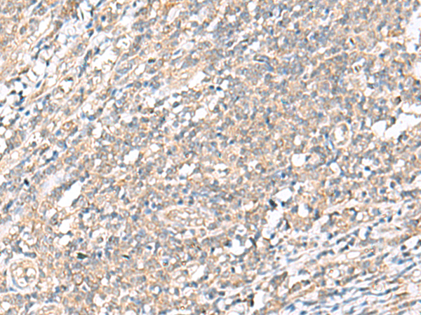 WDR47 Antibody[47729]