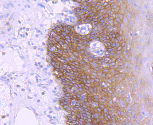 EGFR Rabbit mAb[48691]