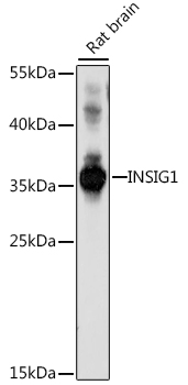 INSIG1 Polyclonal Antibody[297