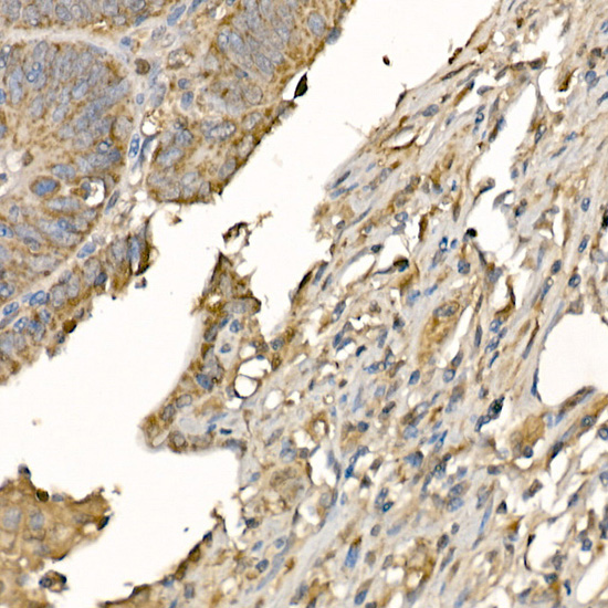 Gasdermin-D Polyclonal Antibod