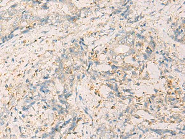 WDR37 antibody[31994]