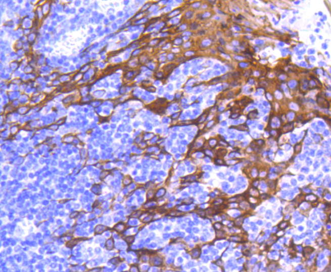 Cytokeratin 6 Rabbit mAb[49086