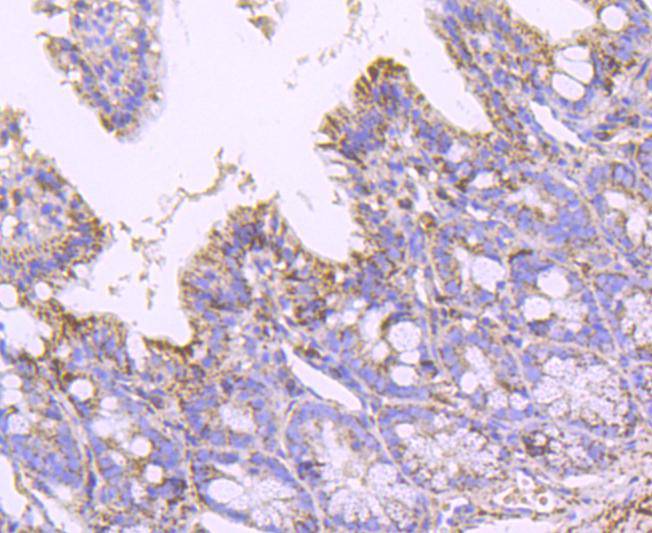 SOD2 Rabbit mAb[49265]
