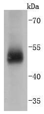 Carbonic anhydrase 9 Rabbit mA