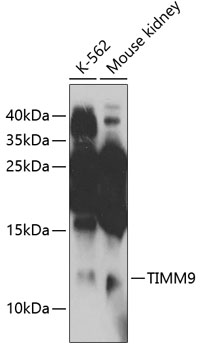 TIMM9 Polyclonal Antibody[3059