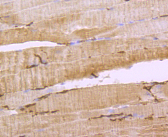 AQP1 Rabbit mAb[49447]