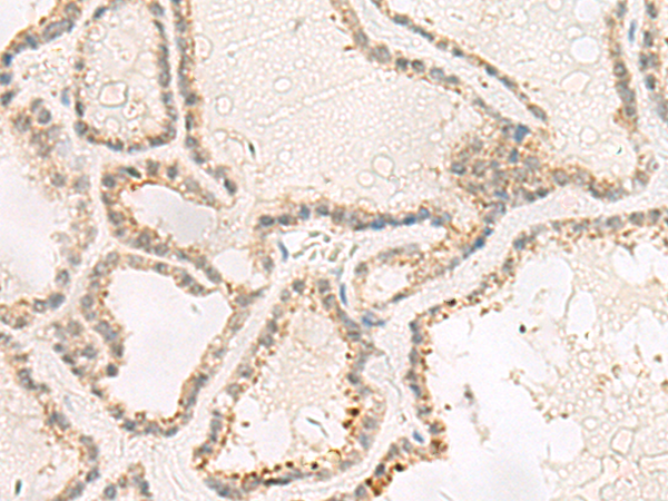TACO1 Antibody[47559]