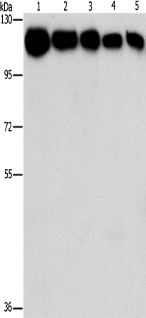 HK1/HK2 antibody[31975]