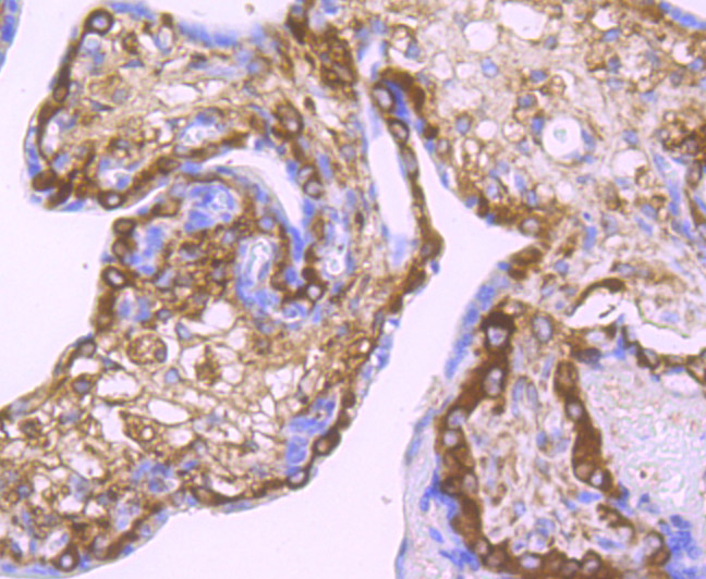 LOXL2 Rabbit mAb[49699]