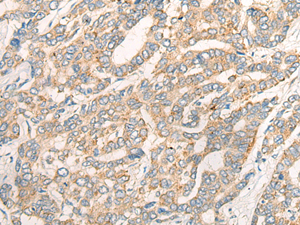CCL16 Antibody[46941]