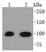 STAT6 Rabbit mAb[48795]