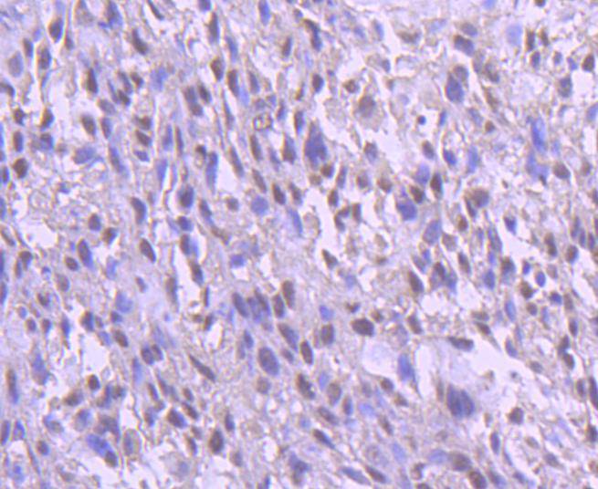 YY1 Rabbit mAb[48730]