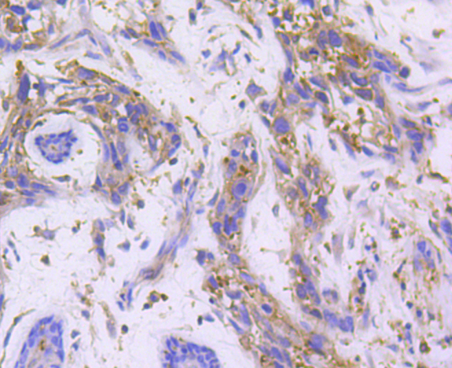 RALBP1 Rabbit mAb[49006]