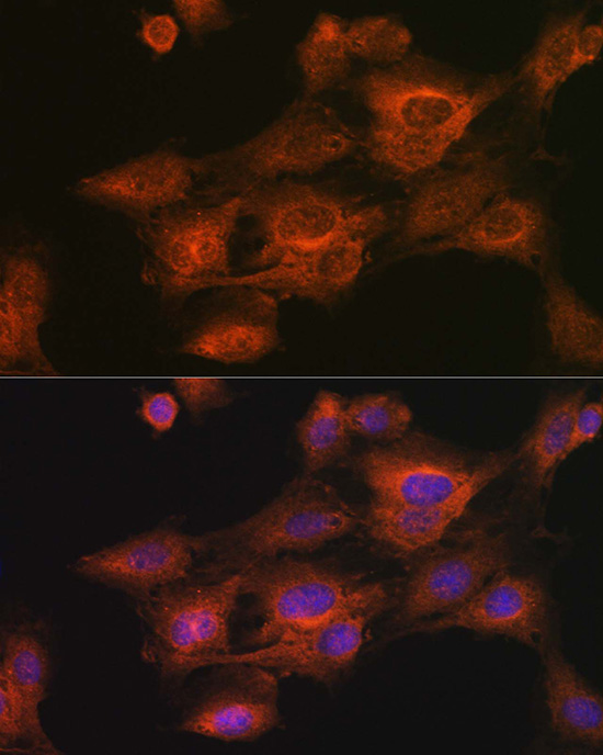 RSPO1 Polyclonal Antibody[3149