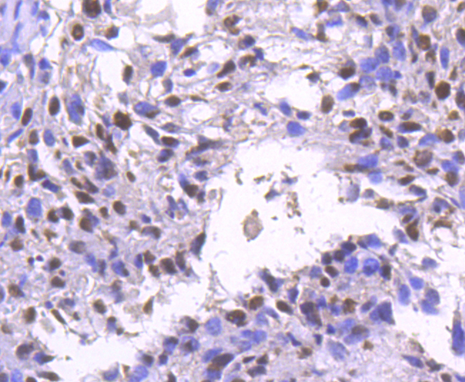 BRG1 Rabbit mAb[49101]