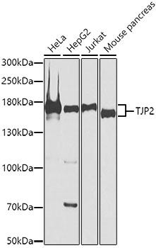 TJP2 Polyclonal Antibody[27233